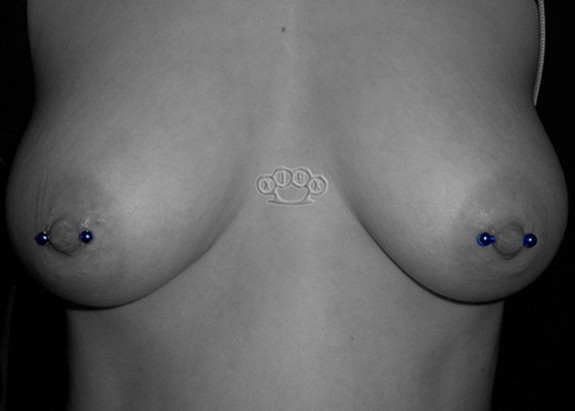 female nipple piercing gallery. Female Horizonal Nipple
