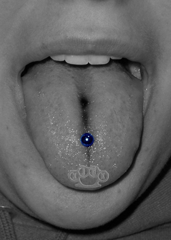 Comments: **Blue colored jewelry is to indicate which piercing I performed