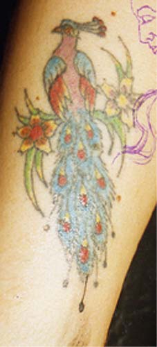 Really bad tattoo Tattoo Galleries: Peacock design